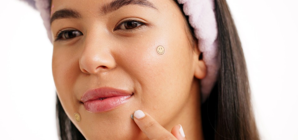 A young woman using patches to cover her pimples