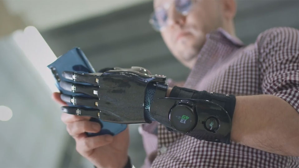 A man with an artificial robotic limb holding a tablet computer