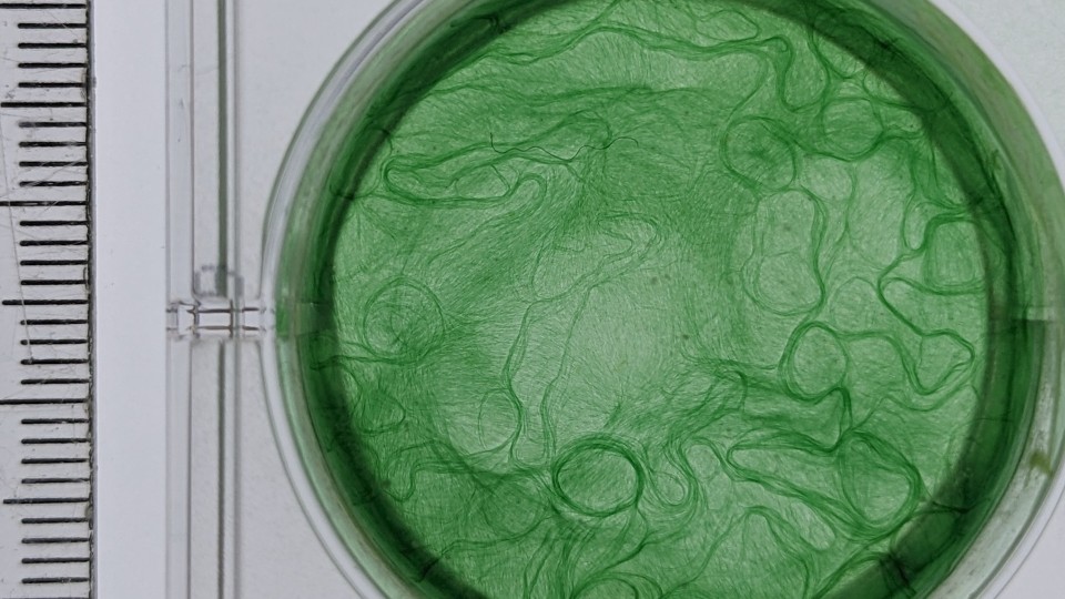 image of green cyanobacteria making a web-like pattern in a petri dish